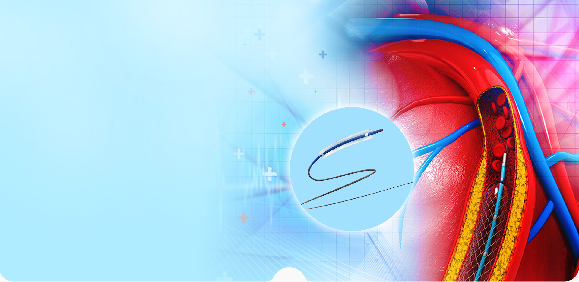 NINGBO LINSTANT POLİMER MALZEMELERİ CO. LTD.