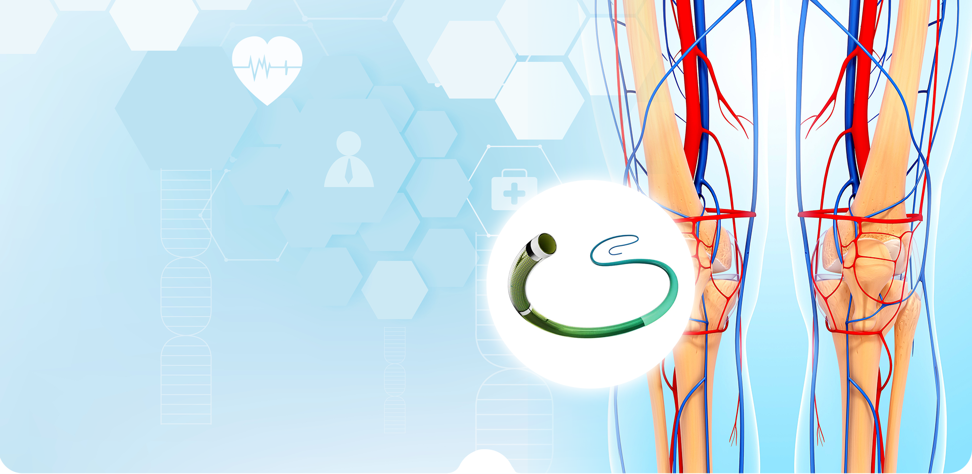 NINGBO LINSTANT POLİMER MALZEMELERİ CO. LTD.